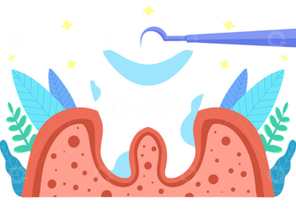 源文件下载【趣麦麦图】扁平蛀牙治疗根管治疗牙医口腔卫生牙齿健康