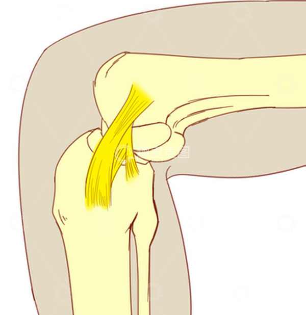 源文件下载【趣麦麦图】膝盖半月板损伤滑膜炎撕裂人骨手绘医学插画