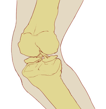 半月板损伤滑膜炎撕裂膝盖结构手绘医学插画