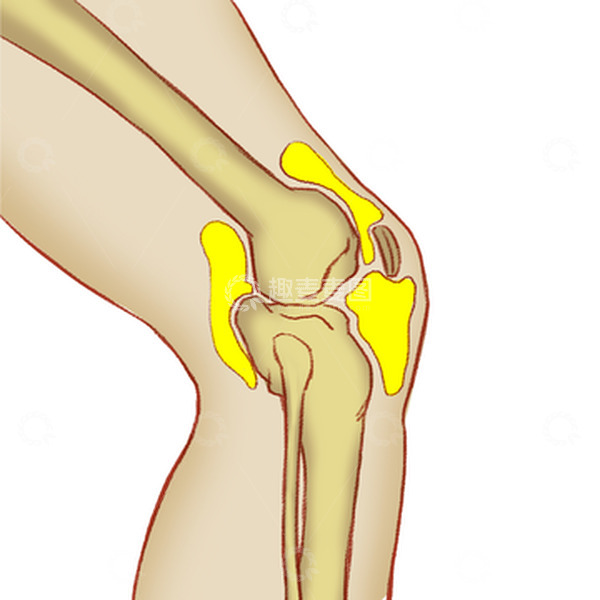 源文件下载【趣麦麦图】半月板损伤滑膜炎撕裂人骨结构手绘医学