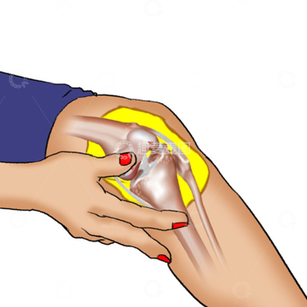 源文件下载【趣麦麦图】膝盖半月板损伤滑膜炎撕裂人骨结构