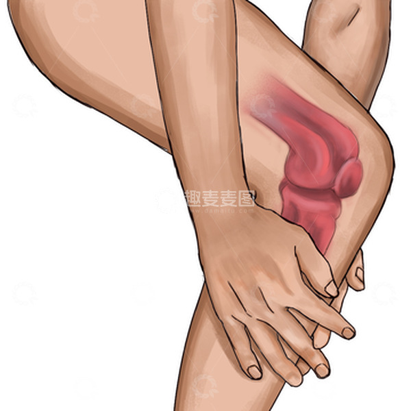 源文件下载【趣麦麦图】膝盖半月板损伤滑膜炎撕裂插画人骨结构