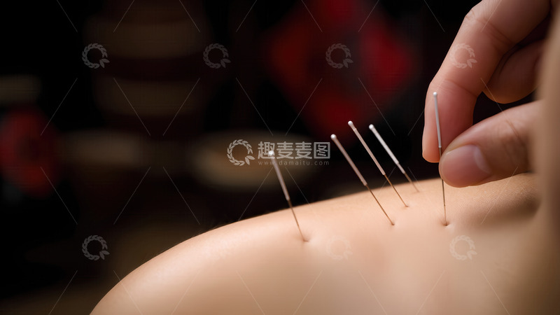 高清大图下载【趣麦麦图】针灸疗法在现代医学中的应用与前景