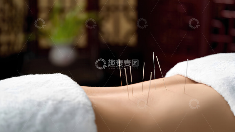 高清大图下载【趣麦麦图】针灸疗法在现代医学中的应用与前景1