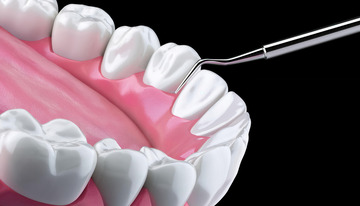 牙科工具清洁牙齿模型演示图