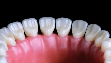 牙齿牙龈模型呈现口腔局部结构