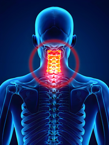 颈椎健康医学图示摄影1