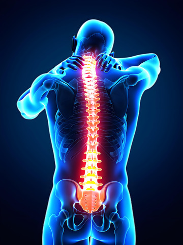 肩颈疼痛医学呈现