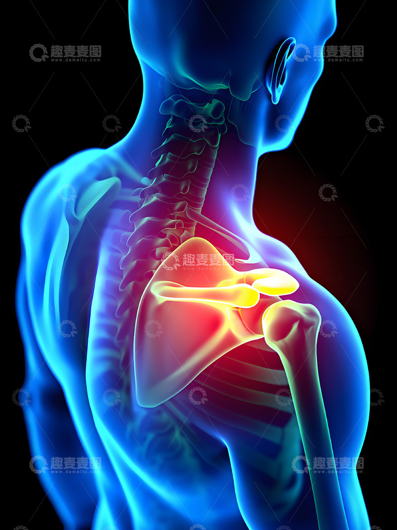 高清大图下载【趣麦麦图】肩痛症状医学展示摄影