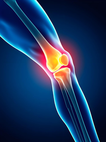 膝盖疼痛医学摄影