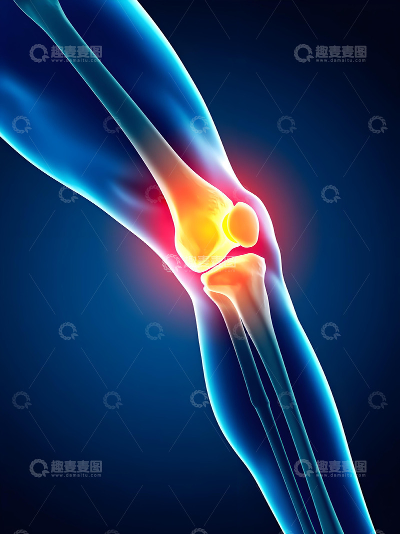 高清大图下载【趣麦麦图】膝盖疼痛医学摄影