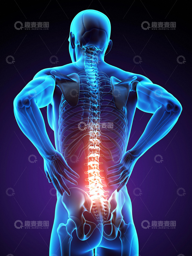 高清大图下载【趣麦麦图】人体腰疼医学摄影
