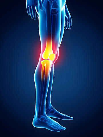 膝盖疼痛医学摄影1