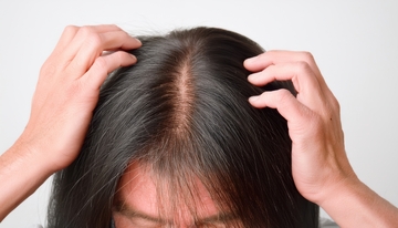 双手查看头顶头发