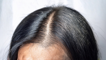 女性头顶白发状况展示