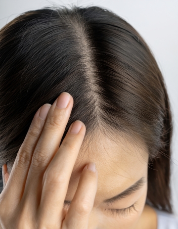 女性手扶发缝面露担忧