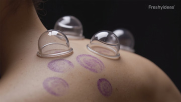 医疗健康中医拔火罐刮痧理疗场景