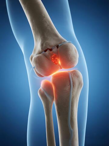 膝关节医学 3D 解剖2