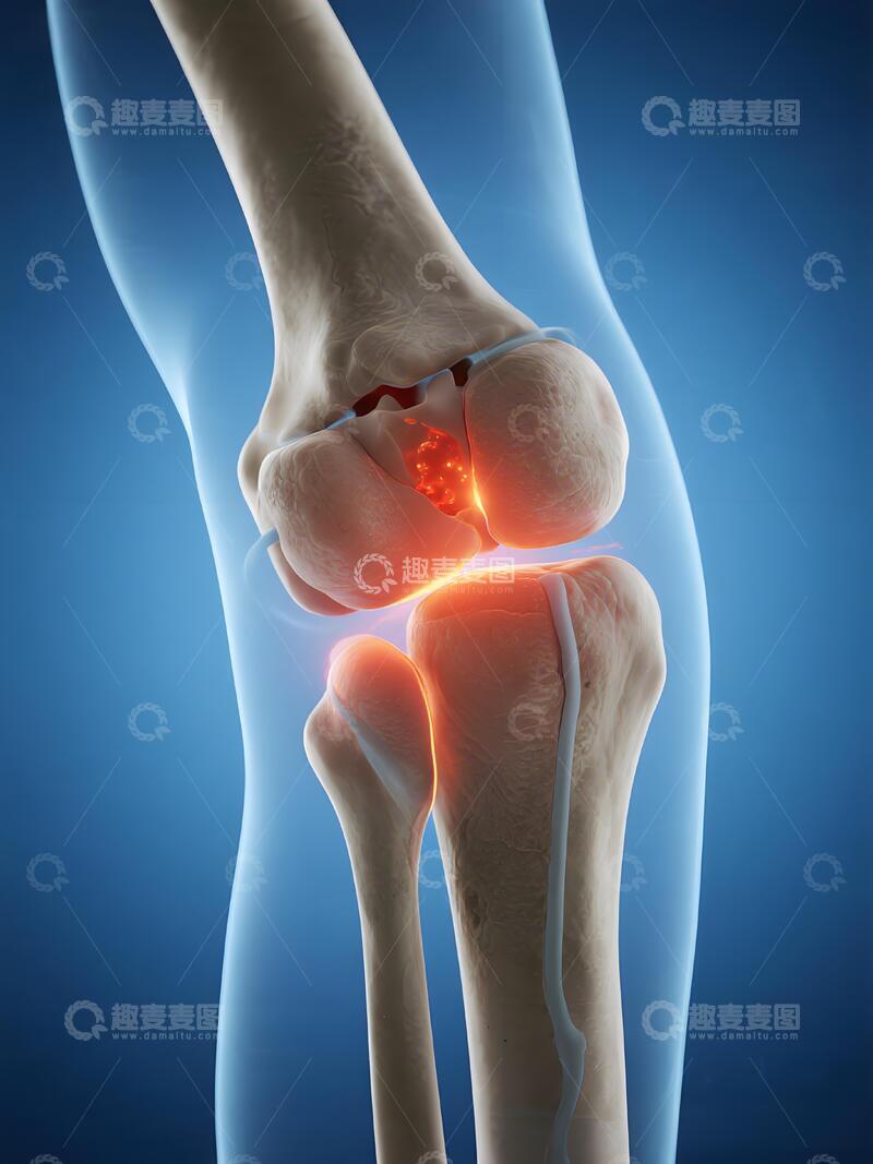 高清大图下载【趣麦麦图】膝关节医学 3D 解剖2