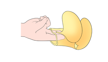 医用插画手部操作