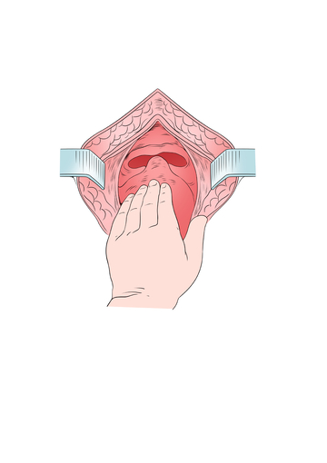手部探查人体内部示意图