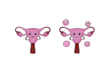 女性子宫健康状态对比图医用插图