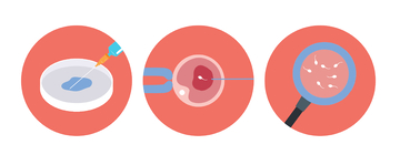 人工授精过程图示医学插画
