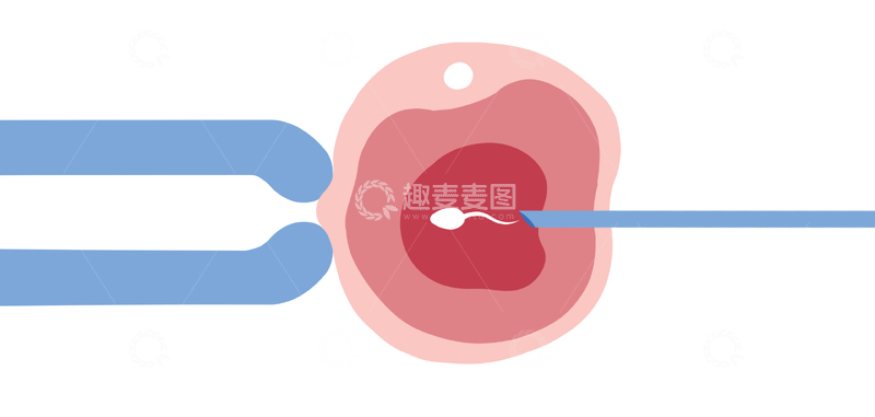 源文件下载【趣麦麦图】人工授精过程示意图医学插画