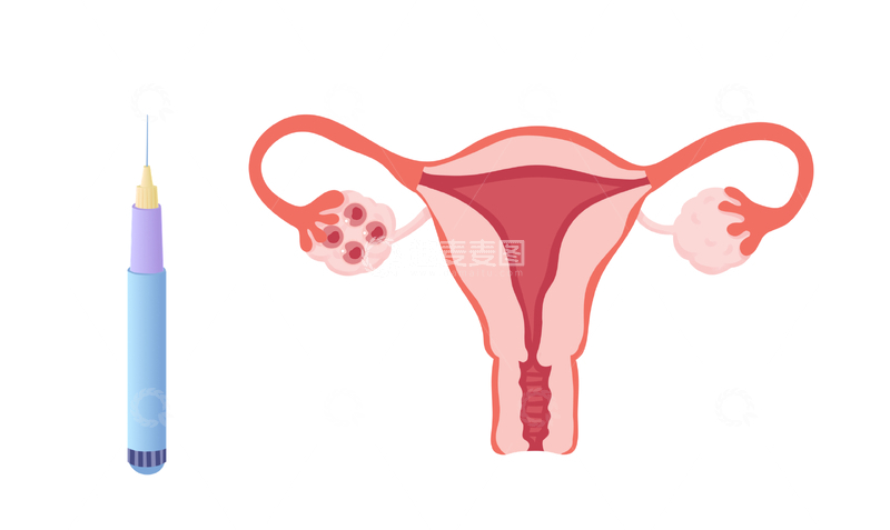源文件下载【趣麦麦图】-女性生殖系统与注射图示