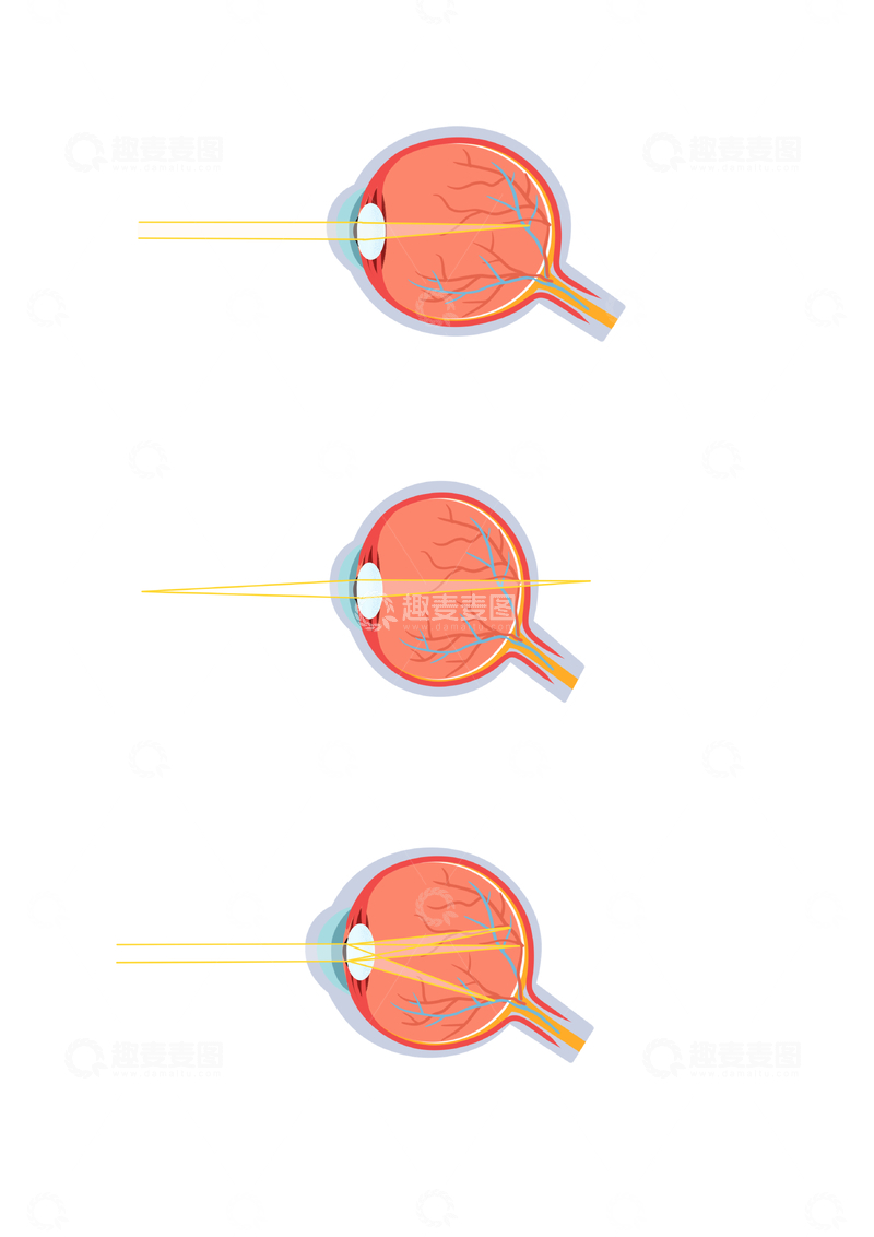 源文件下载【趣麦麦图】-眼睛成像原理示意图