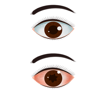 不同眼部形态插画素材用眼健康