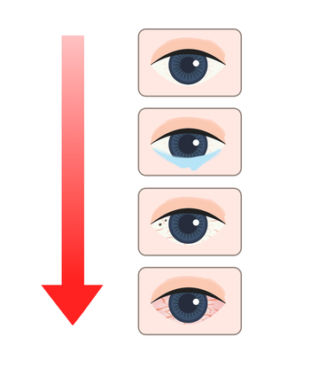 眼睛不同状态变化图示