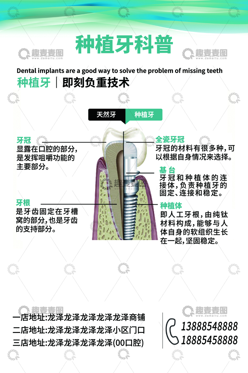 源文件下载【趣麦麦图】种植牙技术详解科普海报